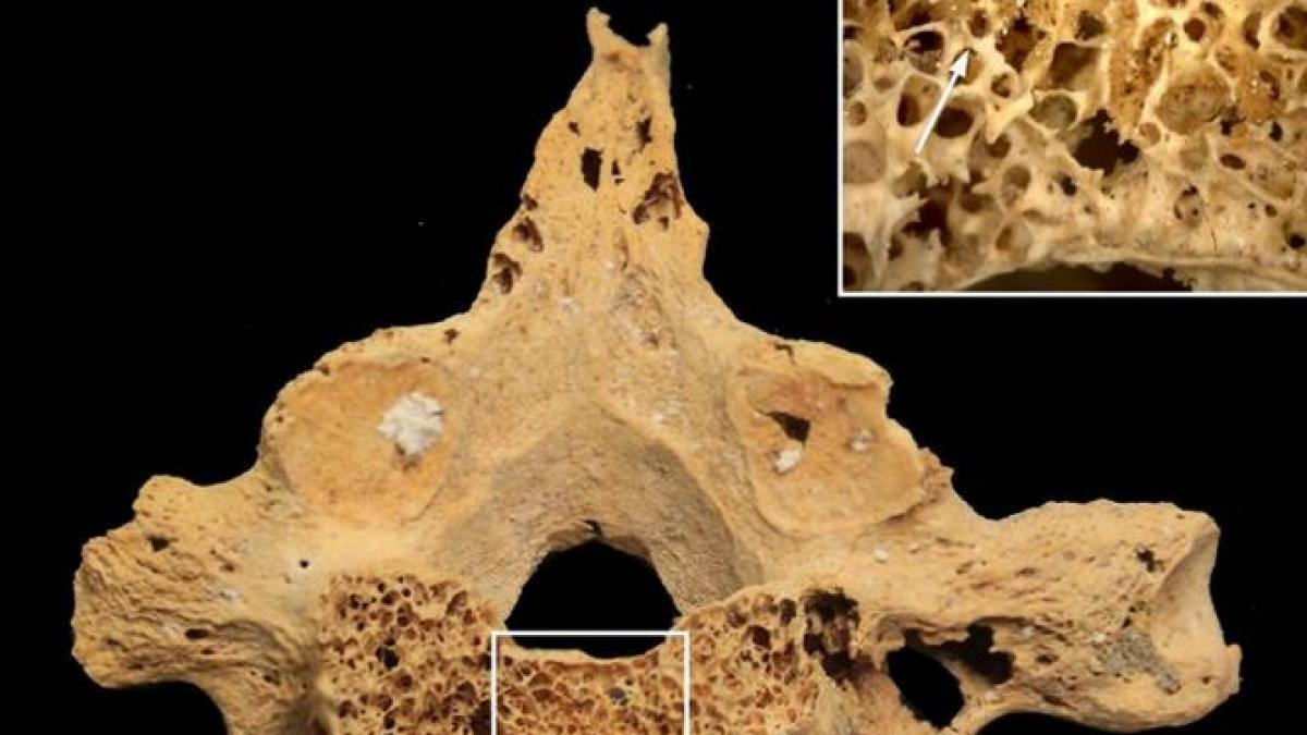 descoperirea remarcabila facuta de oamenii de stiinta ne va ajuta sa intelegem istoria cancerului