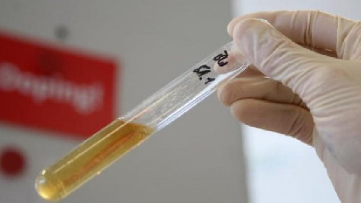 sportivii dopati ar putea fi prinsi mai usor cu ajutorul unui nou tip de test antidoping