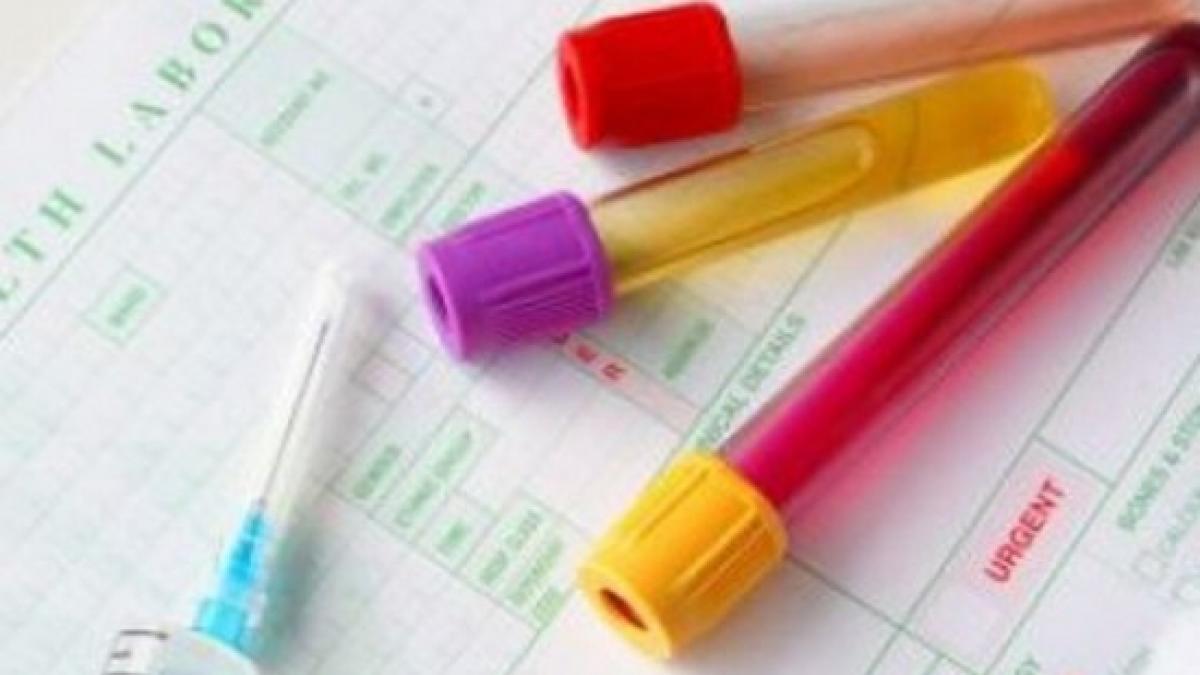 descoperire uluitoare un simplu test de sange poate depista cancerul