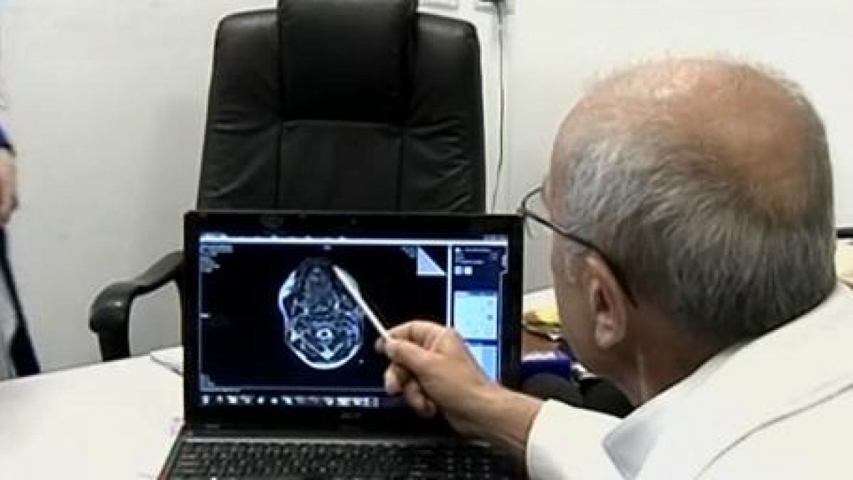 unui pacient bolnav de cancer i se va implanta in locul limbii o bucata din muschiul pectoral