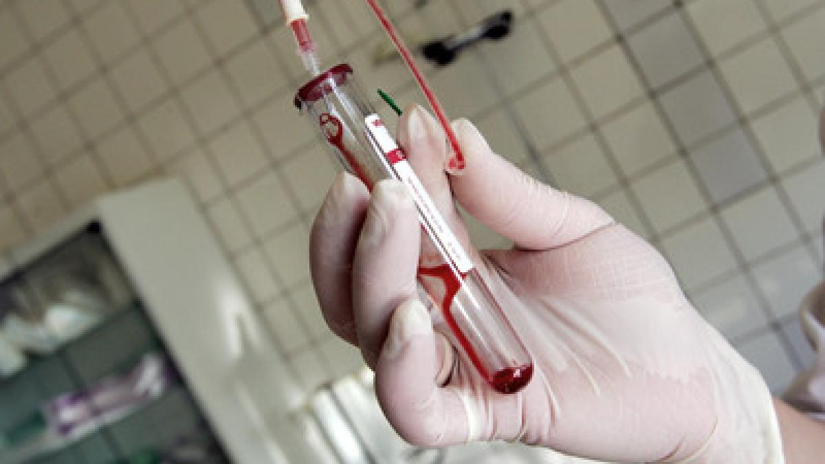 90 din oamenii infestati cu virusul hepatitei c vindecati in doar doua saptamani