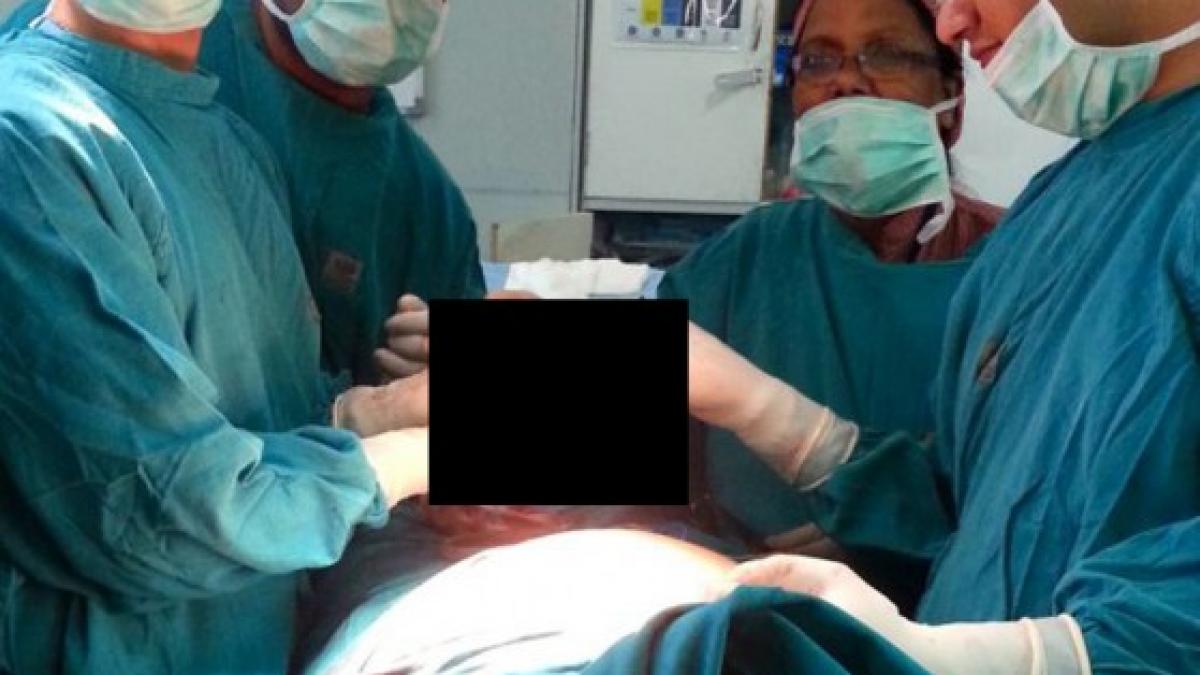 ce au gasit chirurgii in stomacul unui om de afaceri n am vazut in viata noastra asa ceva