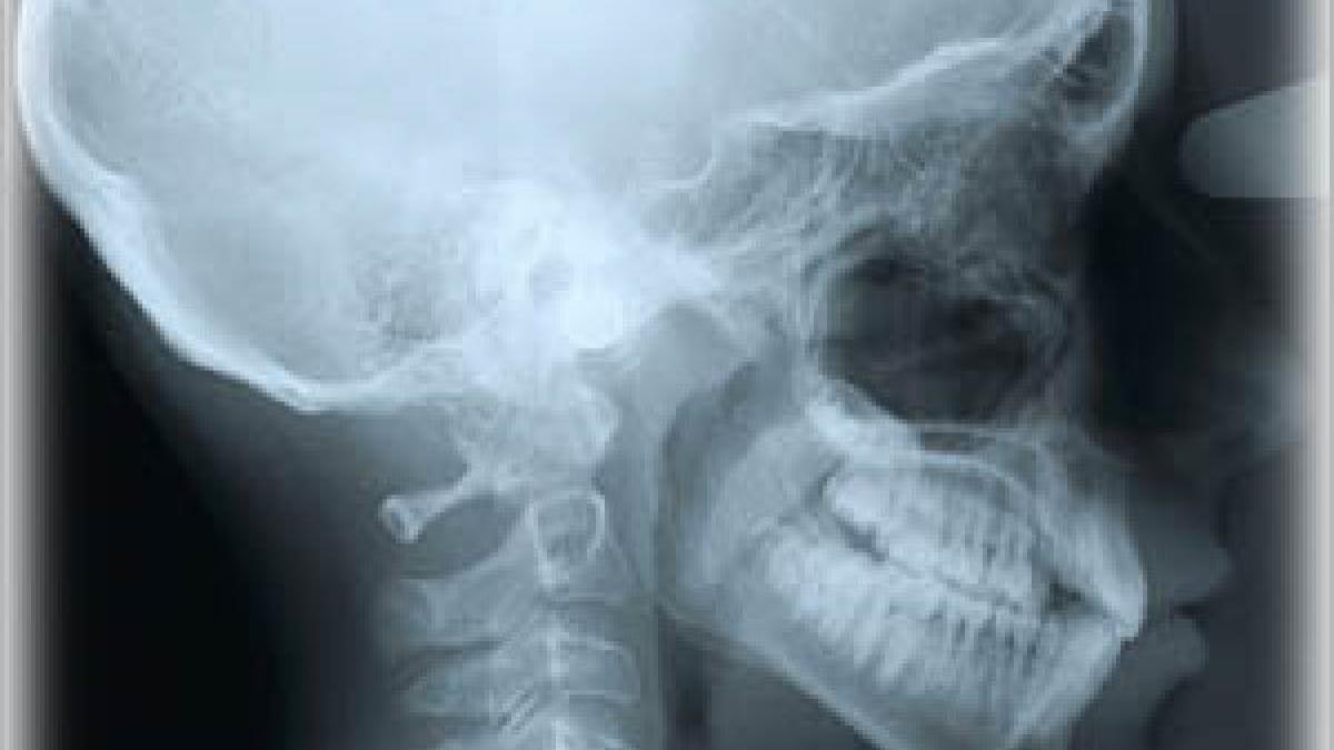 radiografii incurcate la spitalul din targu jiu un copil cu mana fracturata a primit rezultatele