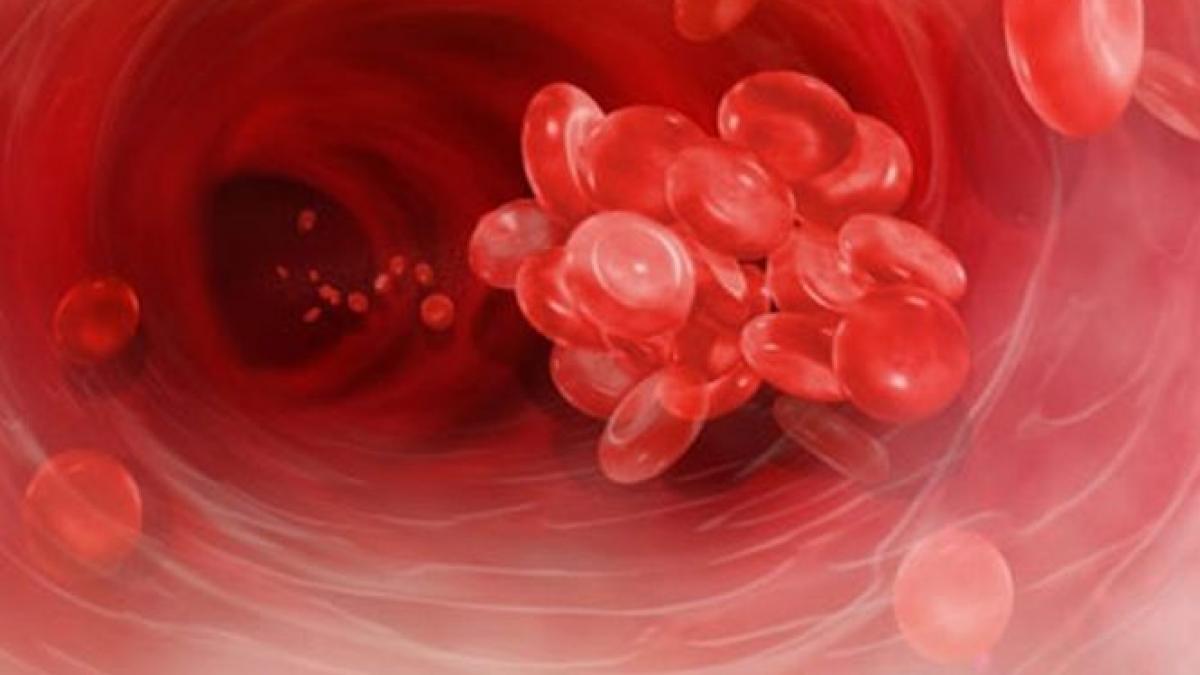 un proiect pentru diagnosticarea si tratamentul trombofiliei derulat de spitalul universitar