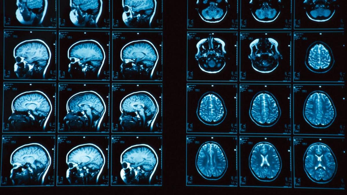 ce au descoperit cercetatorii dupa ce au scanat creierul pedofililor e o anomalie uriasa