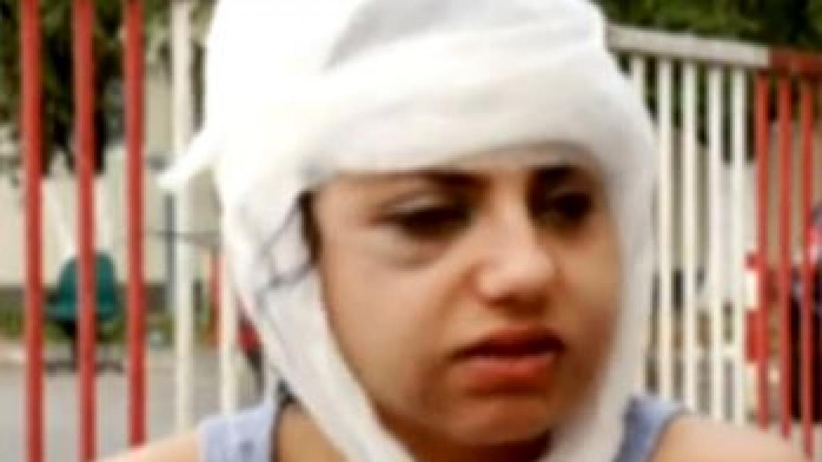 desfigurata din dragoste ma simt umilita un animal haituit si batut nu ma mai simt om