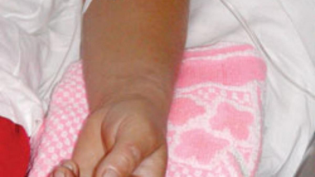 laptele dat gratuit la scoala a trimis 10 elevi pe patul de spital