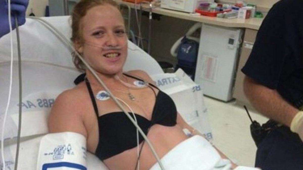 este cea mai norocoasa femeie cum arata dupa ce a fost sfasiata de un rechin