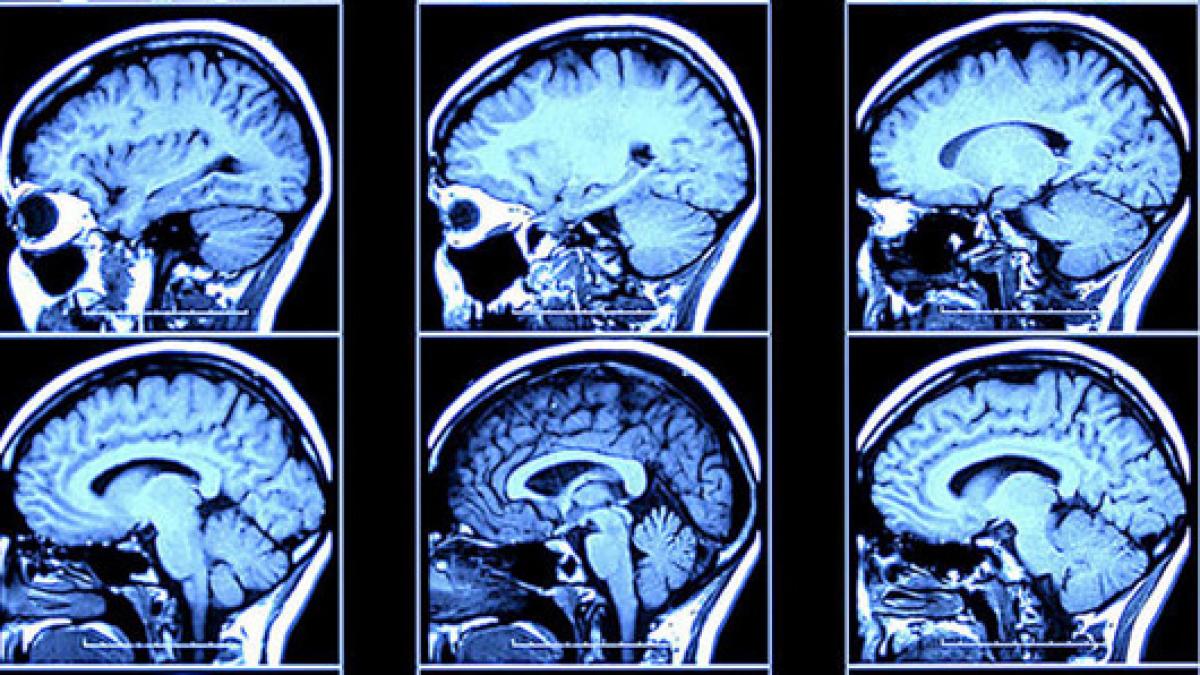 ce se intampla in creierul tau dupa ce nu dormi o noapte cercetatorii sunt extrem de ingrijorati