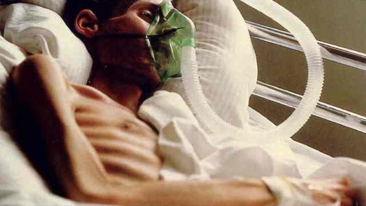 principalele cauze de deces in ultimul secol ce ii omoara azi pe oameni