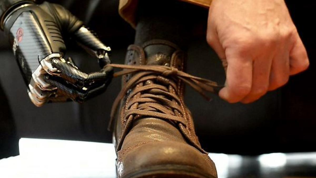 premiera medicala un militar ranit in misiune in afganistan a primit o mana bionica