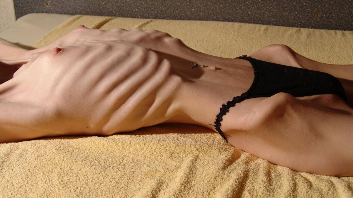 ce se intampla in mintea unei femei anorectice intra pe usa in lateral pentru ca se teme ca nu