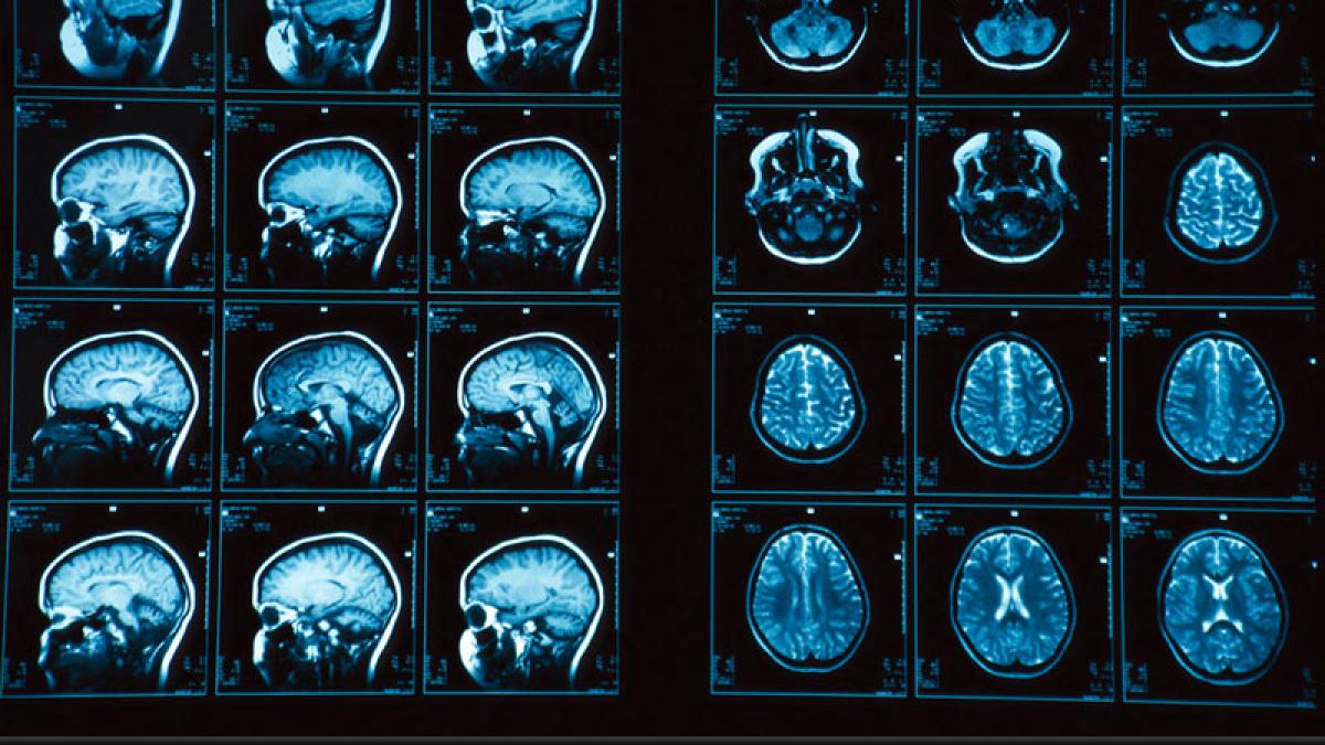 a murit la numai 22 de ani dupa ce medicii l au diagnosticat cu sinuzita si l au trimis acasa