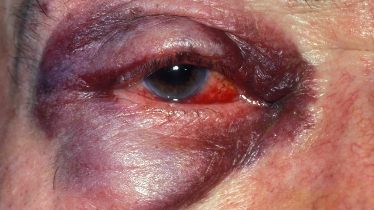 o mama a fost batuta cu salbaticie de o adolescenta de 14 ani intr un parc motivul este revoltator