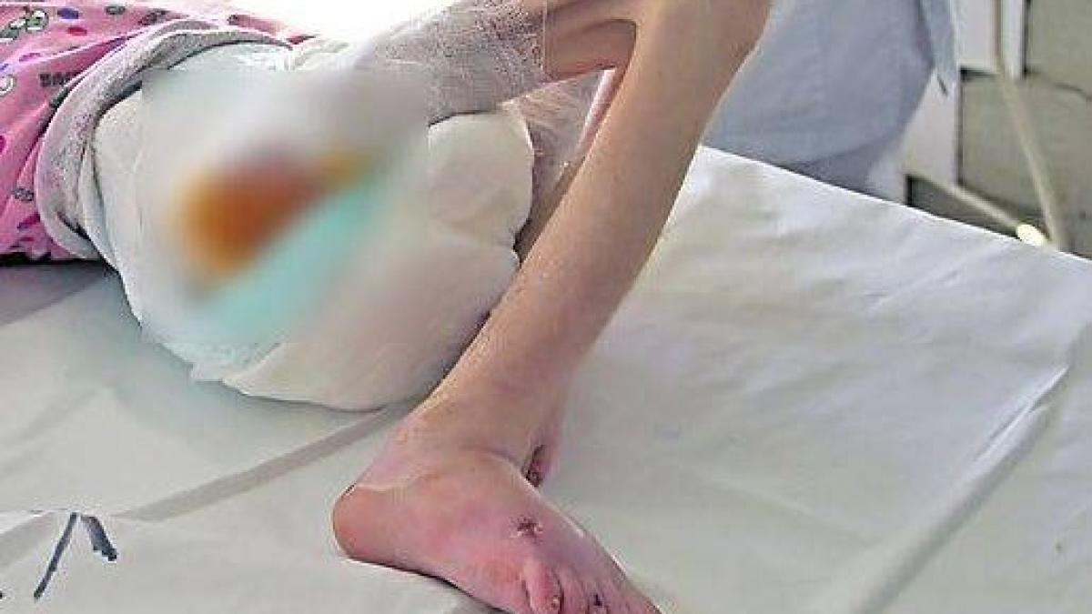 caz socant la brasov o femeie a murit de subnutritie la 67 de ani cantarea 35 de kilograme a fost