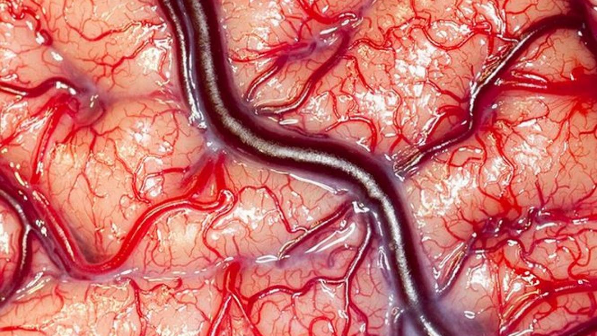 primul model 3d care imita tesutul cerebral viu creat de oamenii de stiinta americani