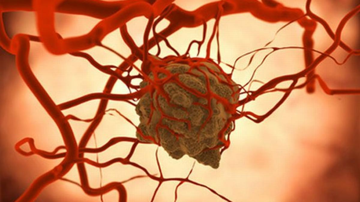 posibil tratament pentru cancer descoperit de cercetatorii americani