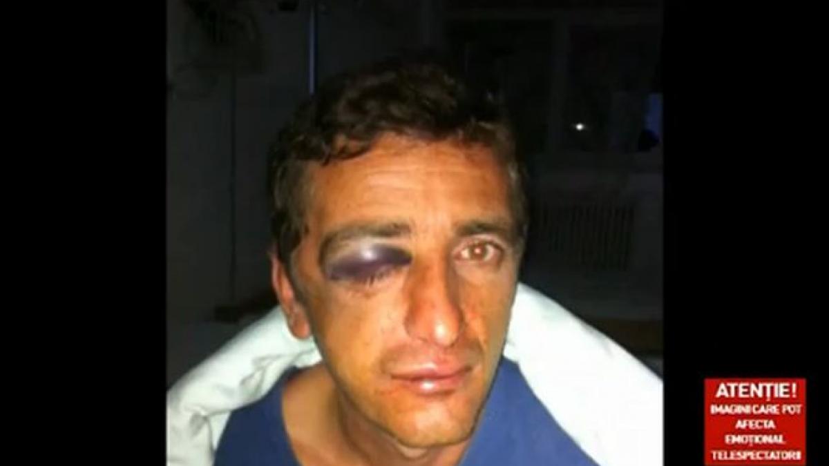 un barbat din caransebes batut cu bestialitate pentru o bucata de pamant