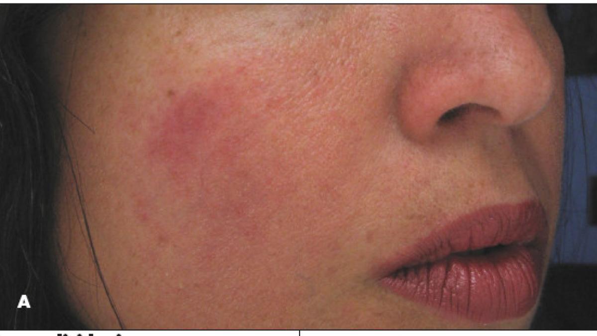 mii de vietati locuiesc pe fata noastra descoperirea cercetatorilor care dezgusta oamenii