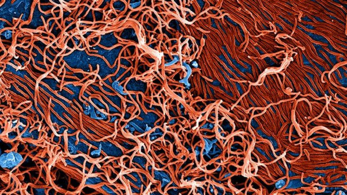 noua metoda pentru detectarea virusului ebola tehnologia permite diagnosticarea in 30 de minute