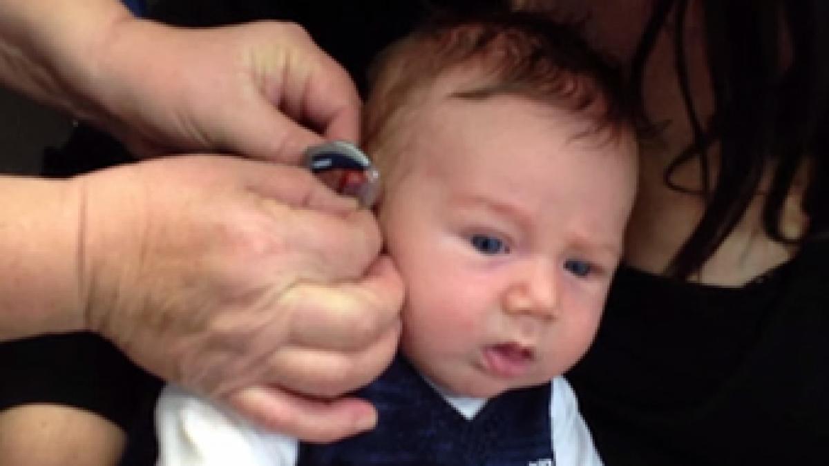 cum reactioneaza acest bebelus nascut surd cand aude pentru prima data peste 8 milioane de oameni s