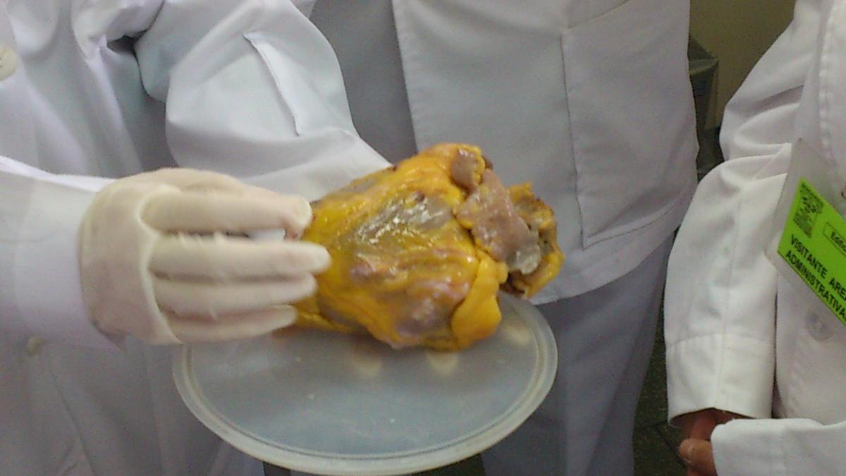 sarea nu are nicio legatura cu hipertensiunea arteriala zaharul este cel mai mare dusman