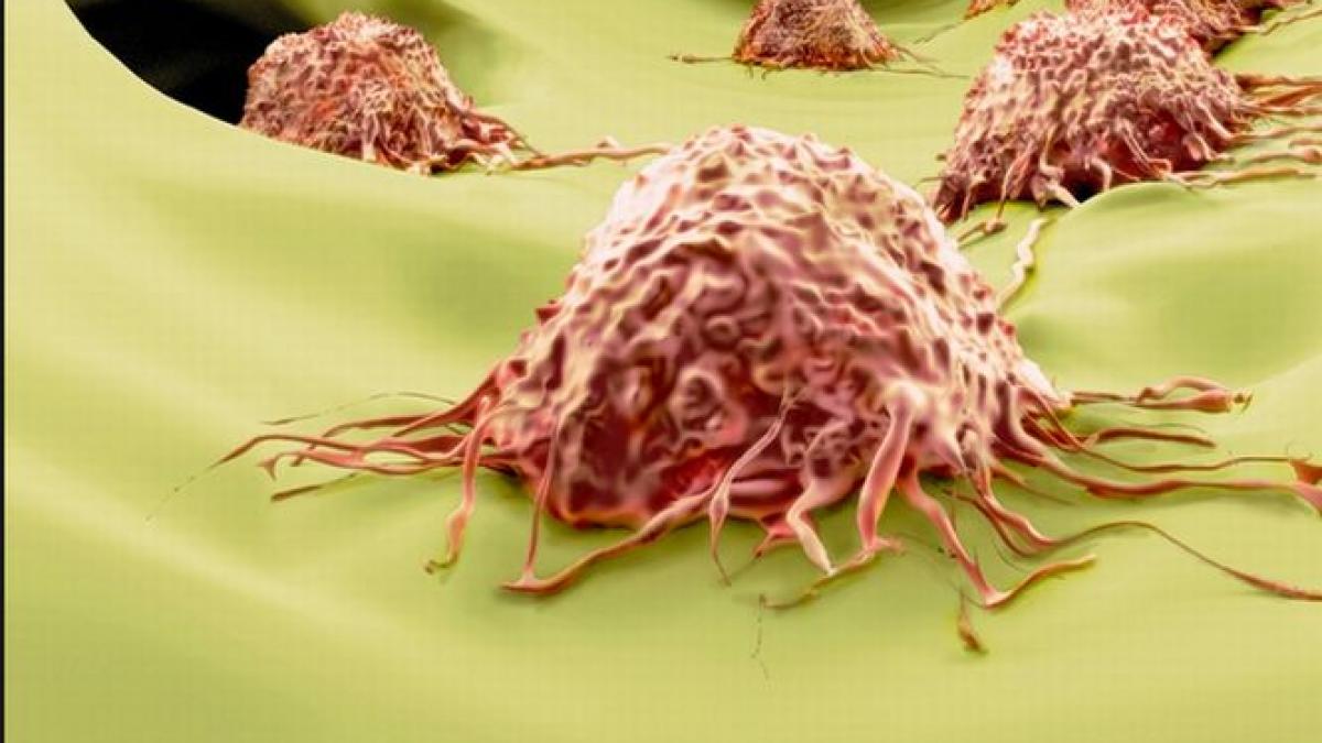 descoperirea care ar putea revolutiona tratamentul cancerului substanta impiedica dezvoltarea