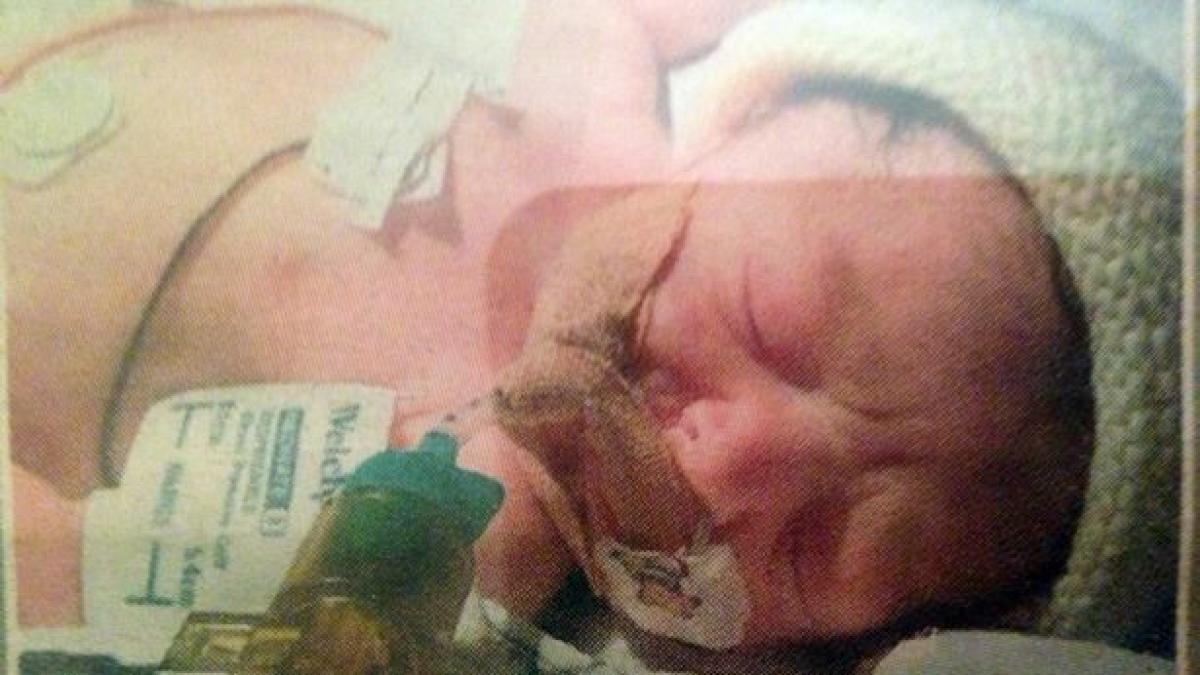 ce s a intamplat dupa patru ani cu fetita care s a nascut fara strop de sange in corp cazul ei este