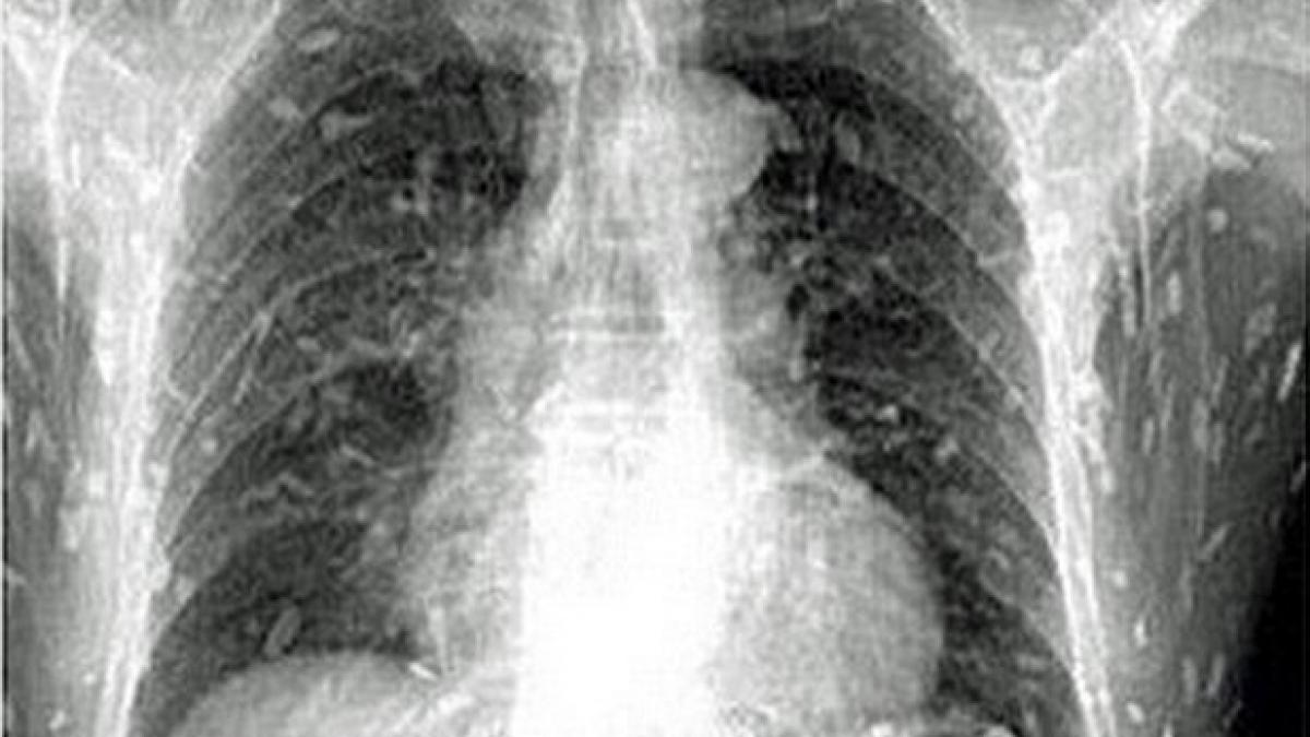 a ajuns la urgente cu dureri de stomac si o senzatie de mancarime pe intreg corpul ce au descoperit