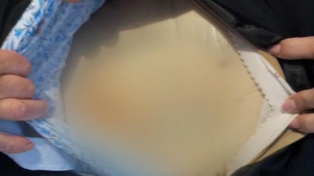 evul mediu in spitalele romanesti o procedura medicala folosita in comunism i a fost fatala unei