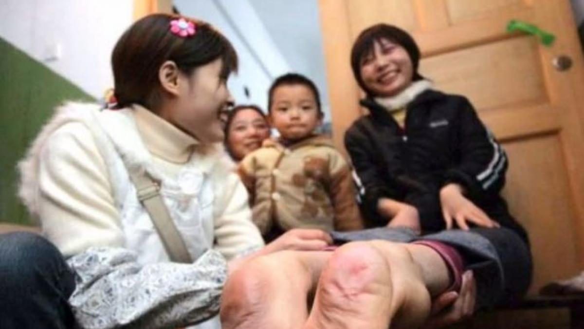 o femeie care s a nascut cu picioarele invers poate alerga mai repede decat multi oameni normali