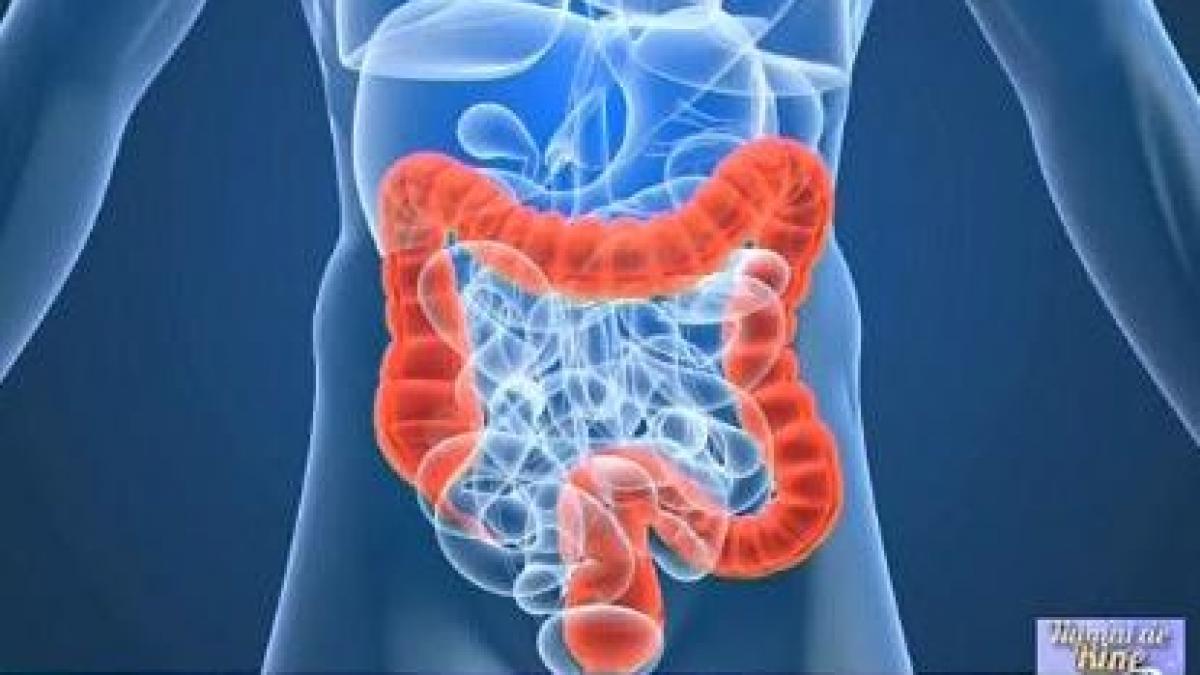 numai de bine cum rezolvi o problema sacaitoare