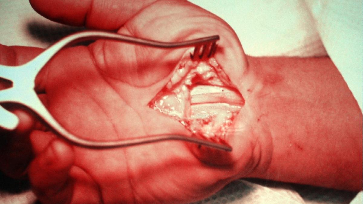 boala pe care o fac persoanele care lucreaza prea mult la calculator iata simptomele