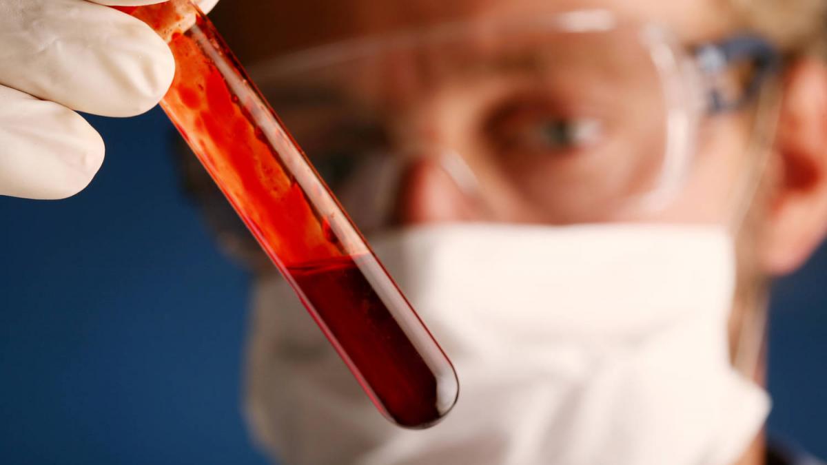 doua cazuri fac senzatie in lumea medicala aveau hiv dar s au vindecat fara tratament