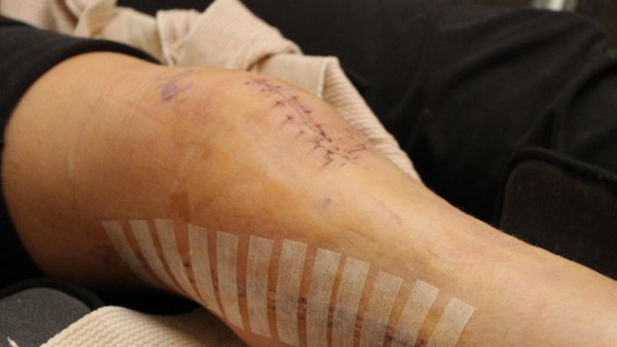 acuzatii grave la spitalul judetean din baia mare o femeie a fost operata la piciorul sanatos