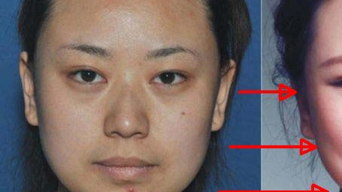 transformarea radicala a acestei tinere cum arata dupa ce si a facut operatie estetica a trebuit sa