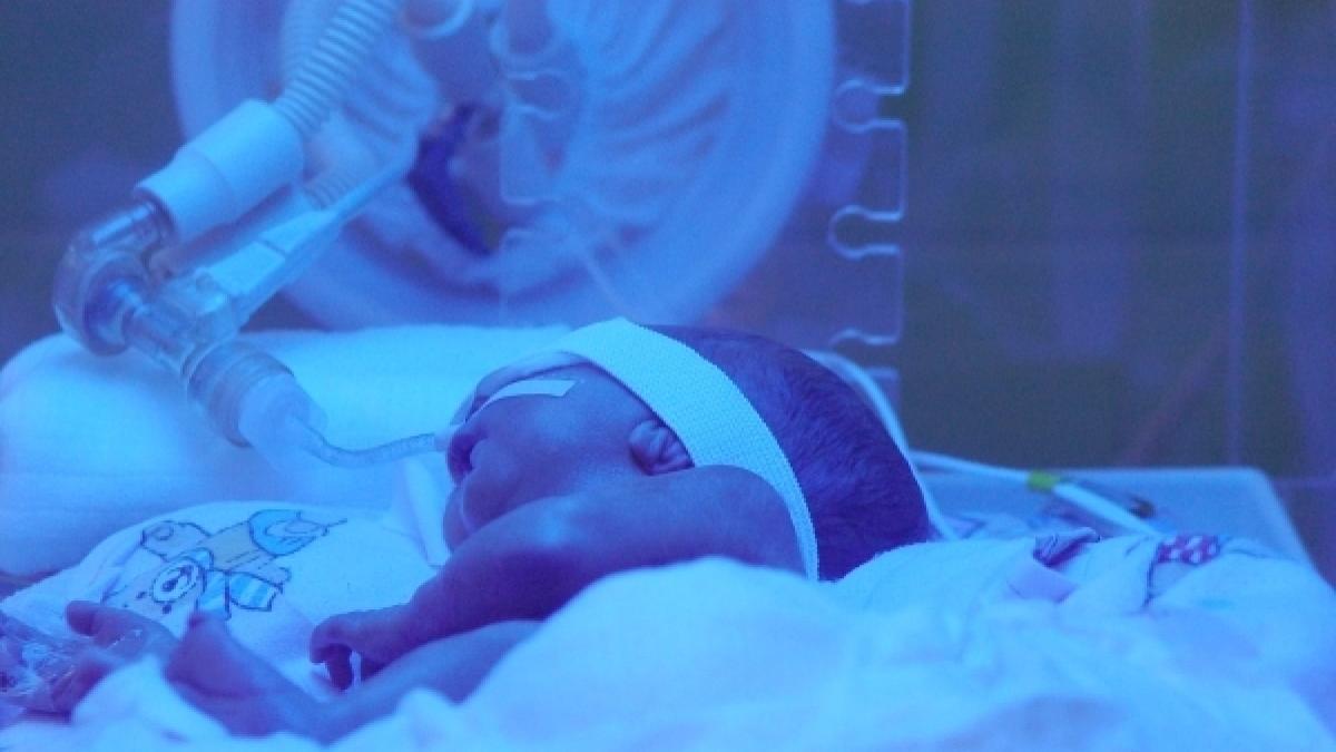 acuzatii grave la adresa medicilor doi bebelusi au orbit dupa ce au stat la incubator iar ochii lor