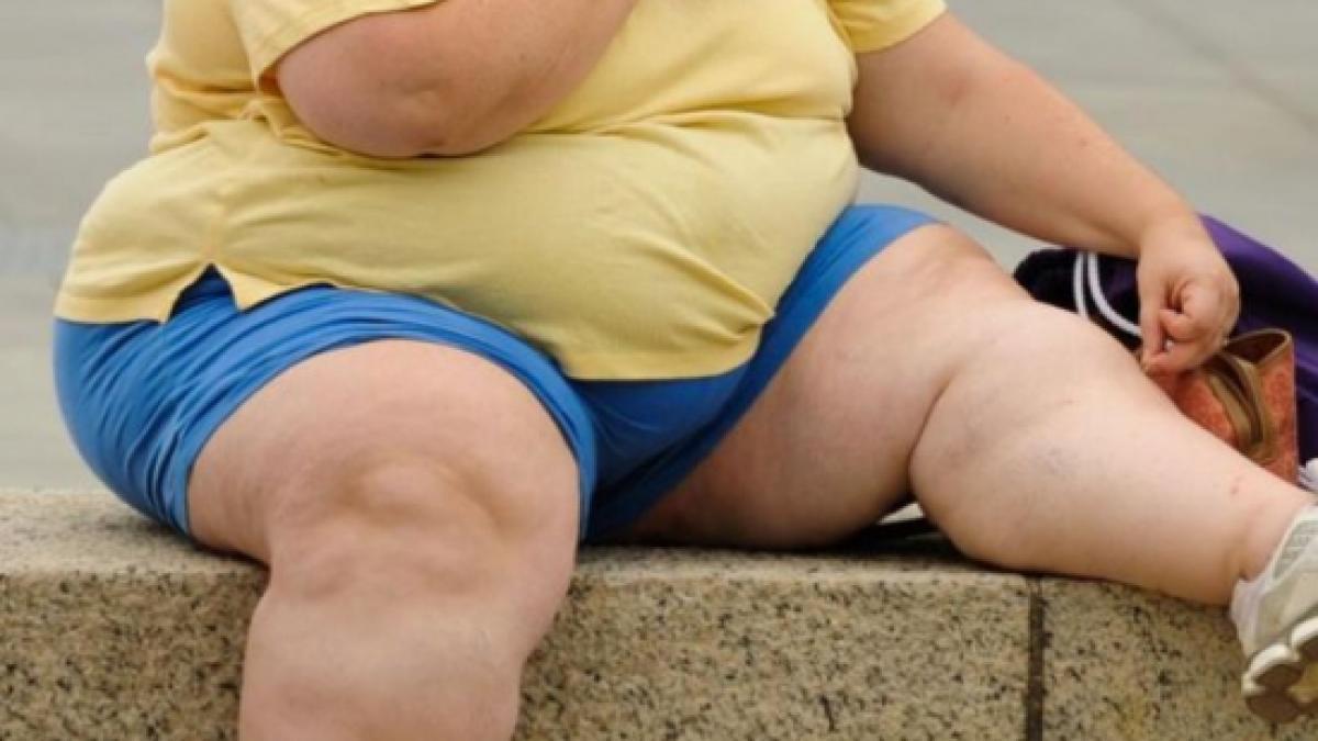 obezitatea reduce semnificativ speranta de viata si anii de viata sanatoasa