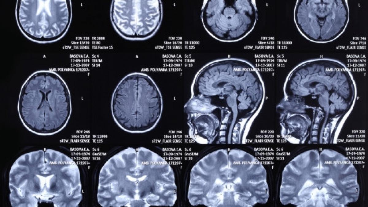 studiul uluitor care arata ce se petrece in corpul tau nici nu banuiam ca omul este capabil de asa