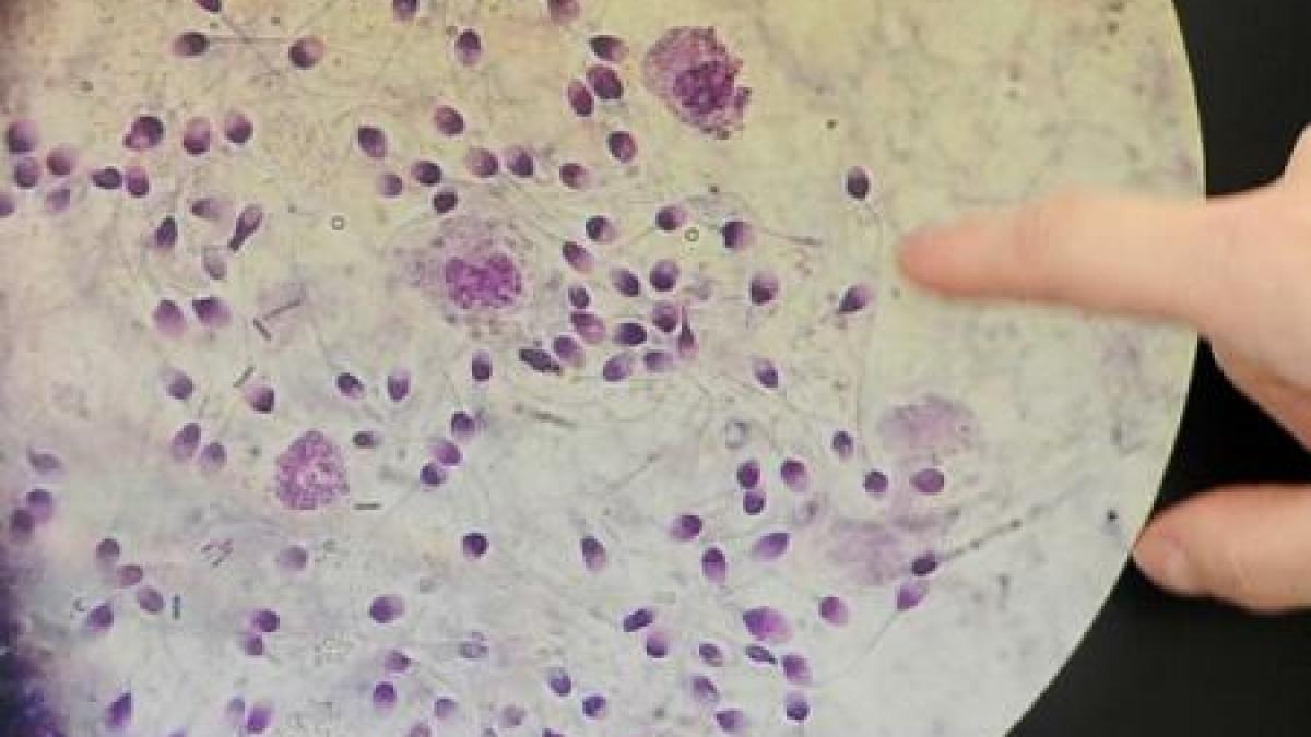 cum raspandesc celulele canceroase in corpul uman raspunsul surprinzator al oamenilor de stiinta