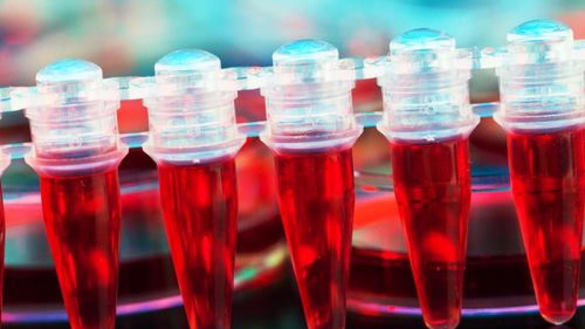 cauza neasteptata care duce la aparitia cancerului in corpul uman