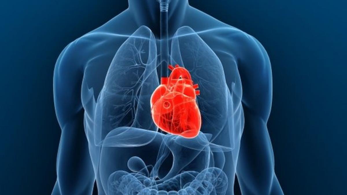 implant de inima artificiala realizat in premiera in romania