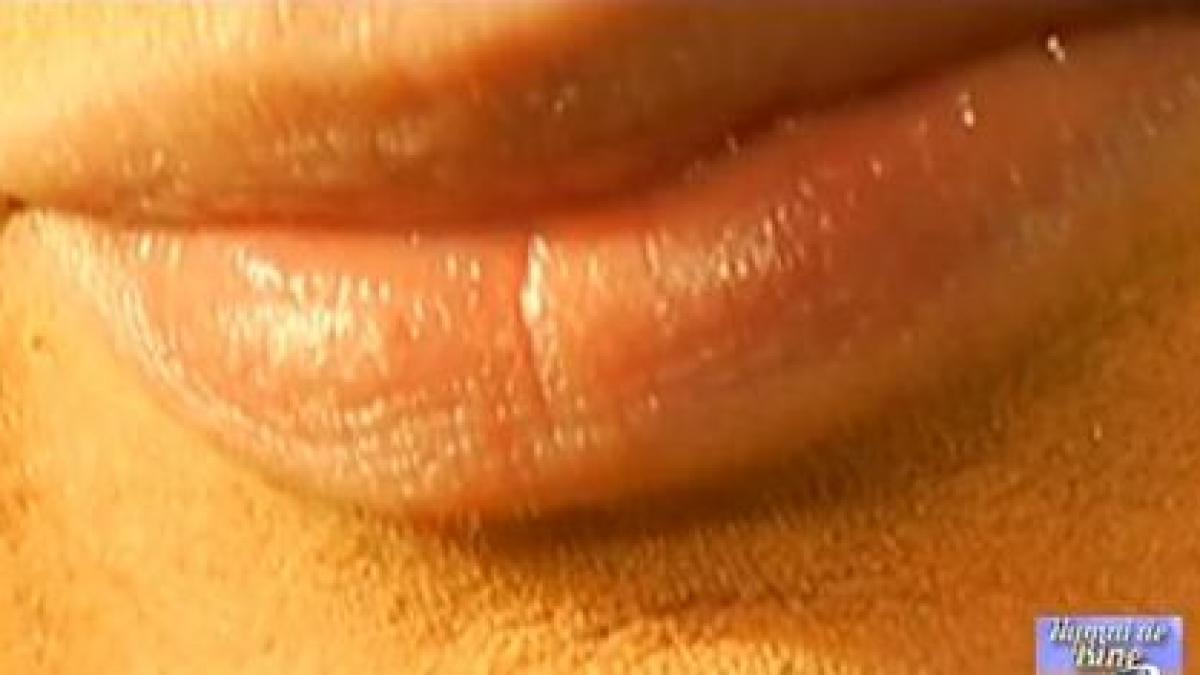 numai de bine buzele crapate intre neglijenta si boala