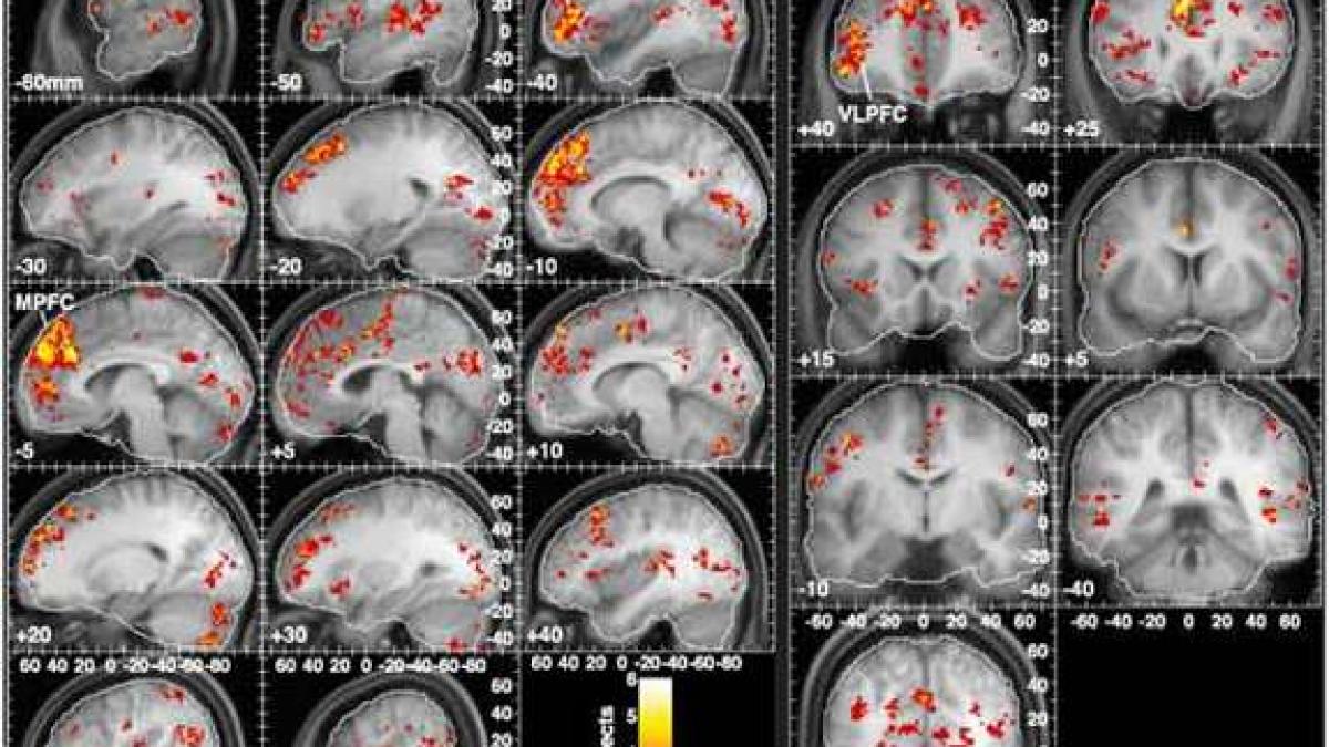 ce se intampla in creierul tau atunci cand asculti muzica este afectat ireversibil