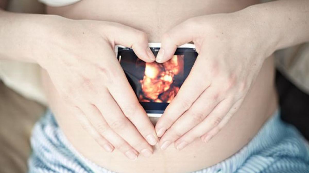 semnul unui bebelus facut din pantecul mamei medicii spun ca nu au vazut niciodata asa ceva