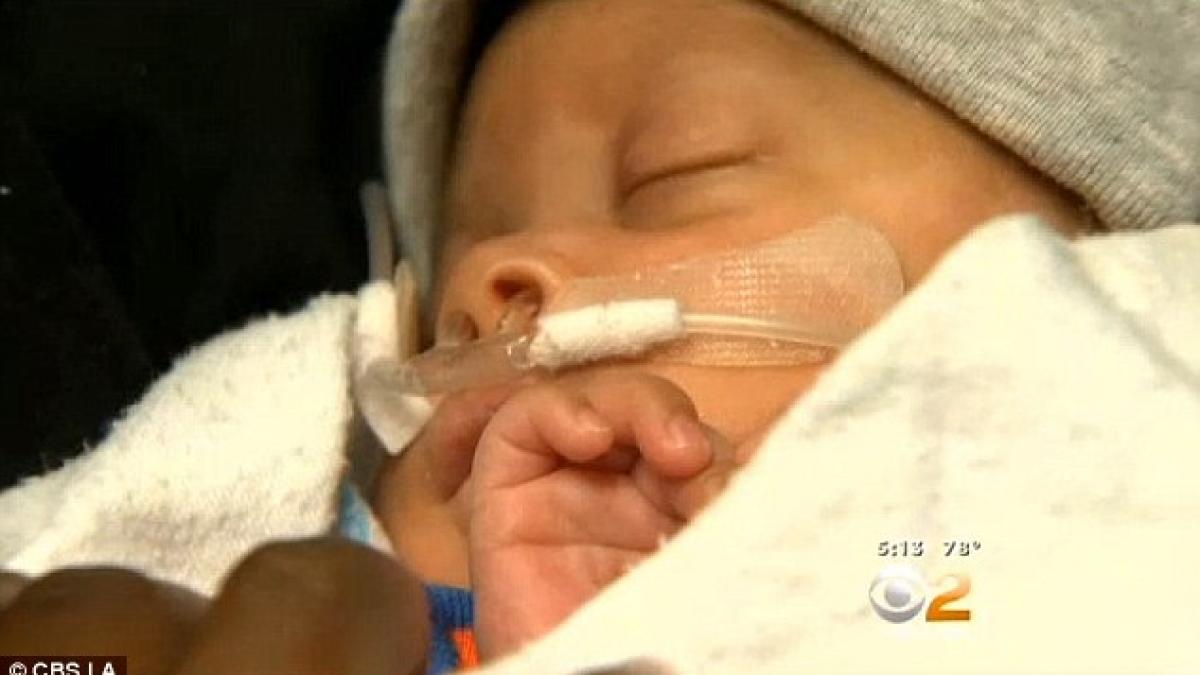 cum s a nascut acest bebelus cu trei luni inainte de termen medicii mi au spus ca este un miracol