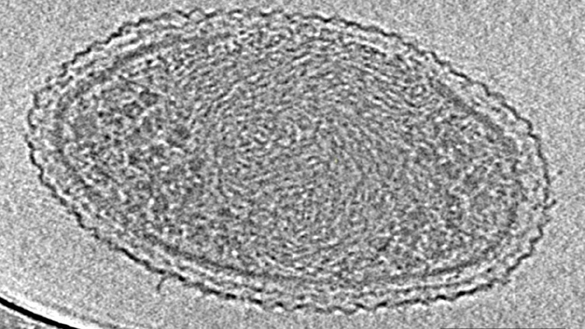 cea mai mica forma de viata de pe pamant a fost descoperita o bacterie ultra mica