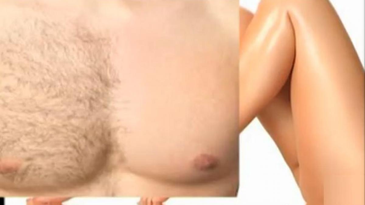 numai de bine epilarea definitiva cu laser si pentru barbati