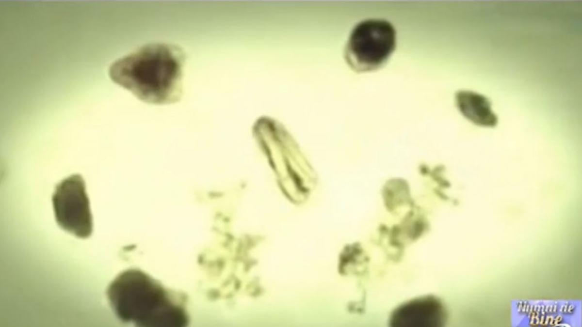 numai de bine parazitii dusmanii ascunsi ai starii de bine