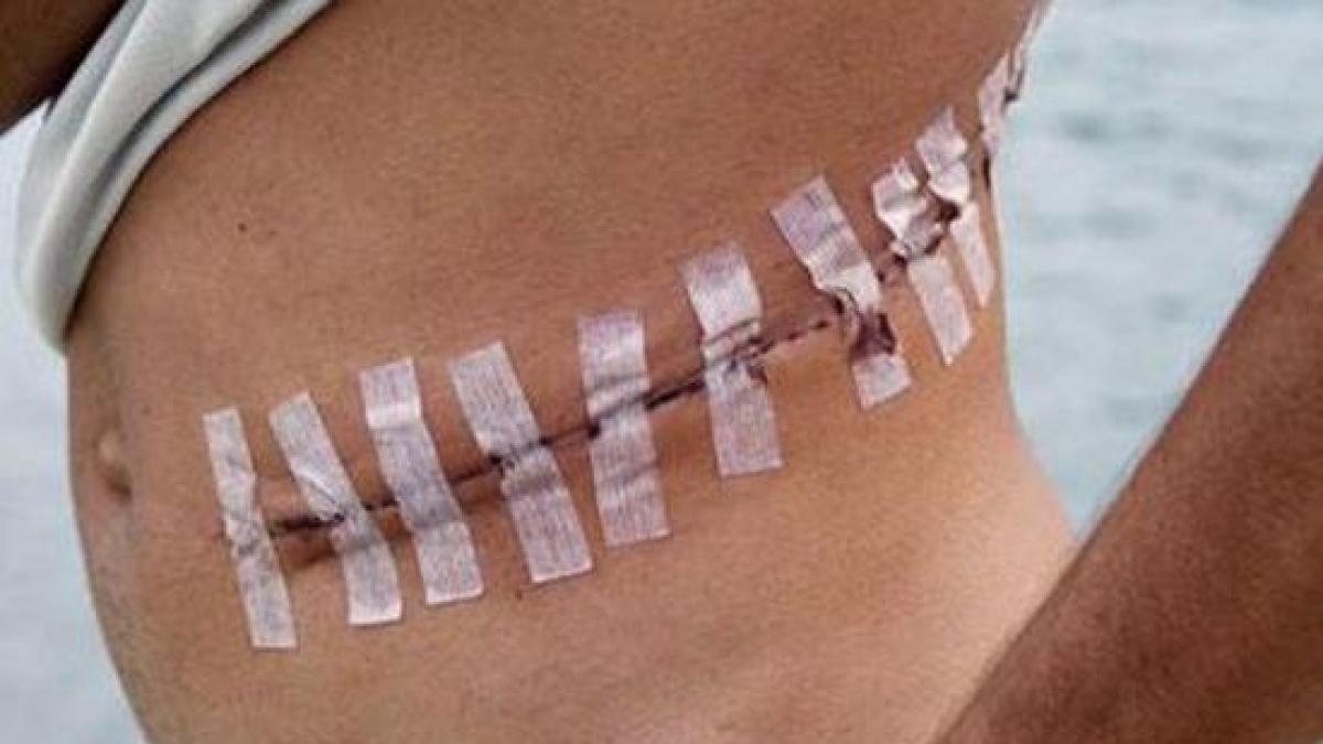 consiliul europei face apel la statele lumii sa semneze conventia impotriva traficului cu organe